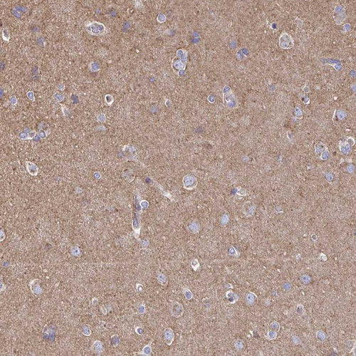 Immunohistochemical staining of human cerebral cortex shows moderate cytoplasmic positivity in neuropil.