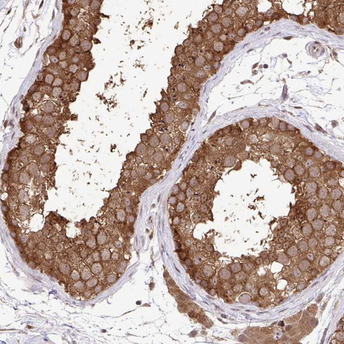 Immunohistochemical staining of human testis shows strong cytoplasmic positivity in cells in seminiferus ducts and Leydig cells.