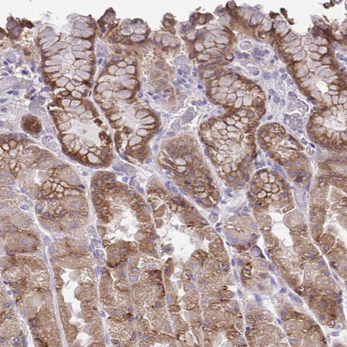 Immunohistochemical staining of human stomach, upper shows moderate cytoplasmic positivity in glandular cells.