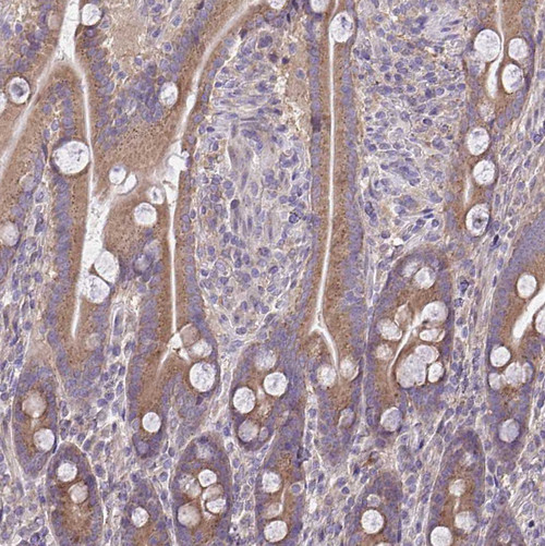 Immunohistochemical staining of human duodenum shows moderate dotted cytoplasmic positivity in glandular cells.