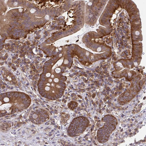 Immunohistochemical staining of human small intestine shows strong cytoplasmic positivity in glandular cells.