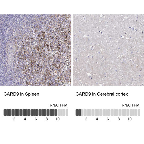 Immunohistochemistry analysis in human spleen and cerebral cortex tissues using HPA059502 antibody. Corresponding CARD9 RNA-seq data are presented for the same tissues.