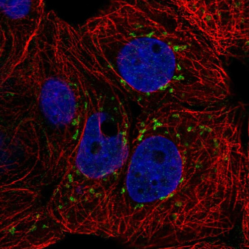 Immunofluorescent staining of human cell line MCF7 shows localization to vesicles.