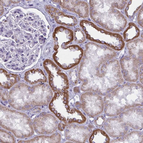 Immunohistochemical staining of human kidney shows strong cytoplasmic positivity in cells in tubules.