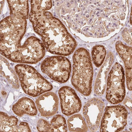 Immunohistochemical staining of human kidney shows strong cytoplasmic positivity in renal tubules.