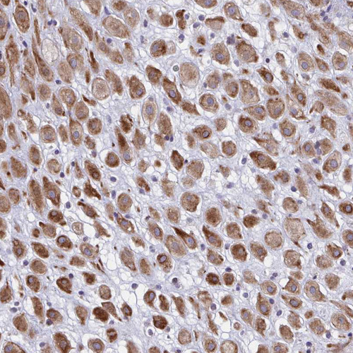 Immunohistochemical staining of human placenta shows strong cytoplasmic and membranous positivity in decidual cells.