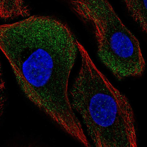 Immunofluorescent staining of human cell line hTCEpi shows localization to cytosol.