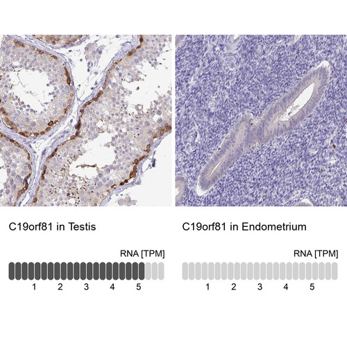 Immunohistochemistry analysis in human testis and endometrium tissues using Anti-C19orf81 antibody. Corresponding C19orf81 RNA-seq data are presented for the same tissues.