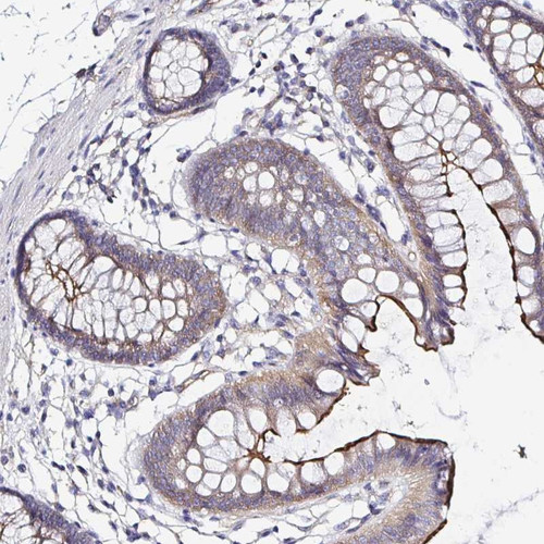 Immunohistochemical staining of human colon shows strong membranous positivity in glandular cells.