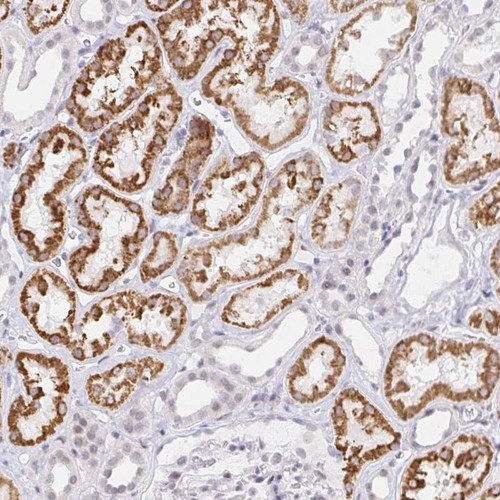 Immunohistochemical staining of human kidney shows strong cytoplasmic positivity in cells in tubules.