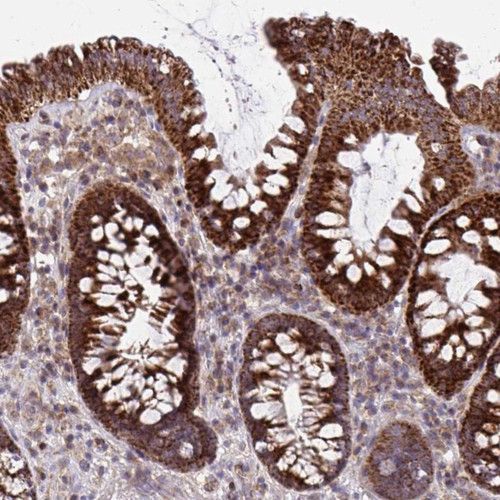 Immunohistochemical staining of human colon shows strong cytoplasmic positivity in glandular cells.