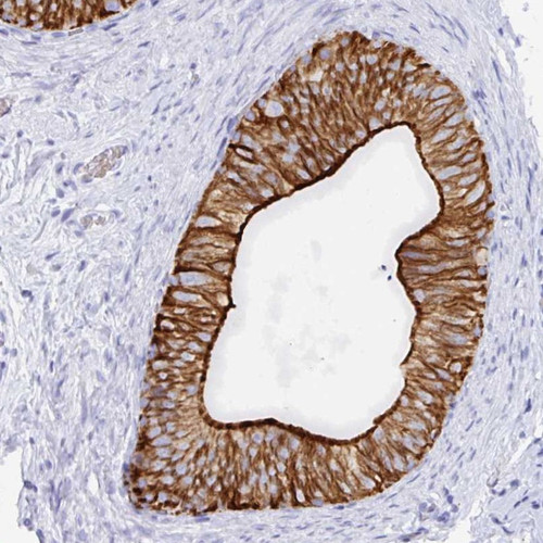 Immunohistochemical staining of human epididymis shows strong cytoplasmic and membranous positivity in glandular cells.