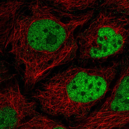 Immunofluorescent staining of human cell line CACO-2 shows localization to nucleoplasm.