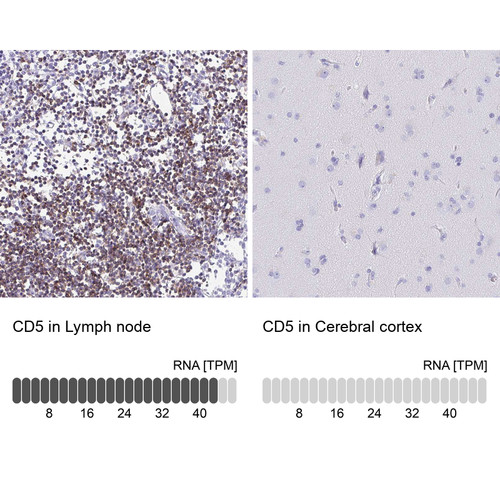 Immunohistochemistry analysis in human lymph node and cerebral cortex tissues using Anti-CD5 antibody. Corresponding CD5 RNA-seq data are presented for the same tissues.