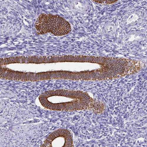 Immunohistochemical staining of human uterus, pre-menopause shows strong cytoplasmic and membranous positivity in glandular cells.