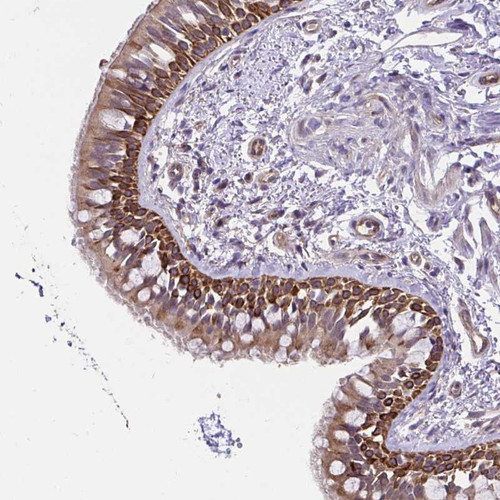 Immunohistochemical staining of human bronchus shows distinct cytoplasmic positivity in respiratory epithelial cells.
