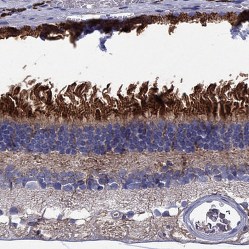 Immunohistochemical staining of human retina shows strong cytoplasmic positivity in photoreceptor cells and and pigment epithelium.