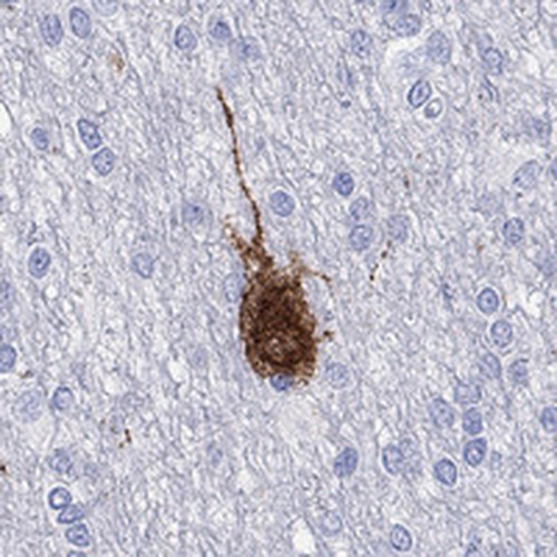 Immunohistochemical staining of human cerebral cortex shows strong cytoplasmic positivity in neurons.