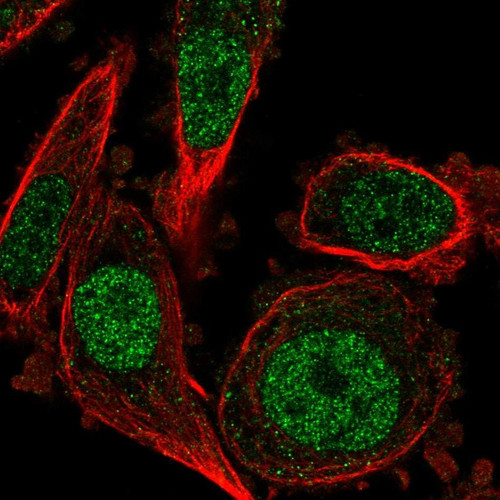 Immunofluorescent staining of human cell line PC-3 shows localization to nucleoplasm.