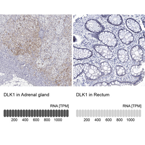 Immunohistochemistry analysis in human adrenal gland and rectum tissues using HPA062262 antibody. Corresponding DLK1 RNA-seq data are presented for the same tissues.