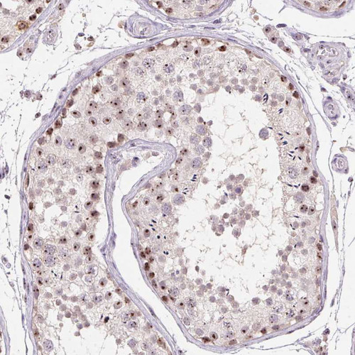Immunohistochemical staining of human testis shows strong positivity in nucleoli in cells in seminiferous ducts.