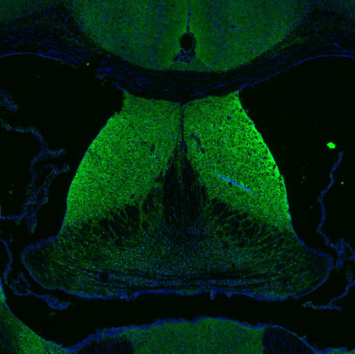 Immunofluorescence staining of mouse brain shows moderate synaptic and peri-nuclear staining in lateral septum.