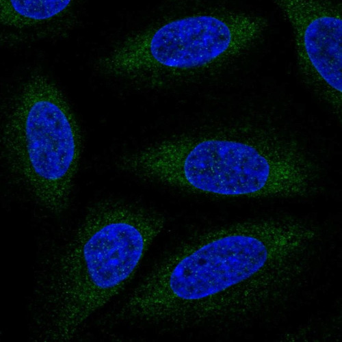 Immunofluorescent staining of human cell line SiHa shows localization to endoplasmic reticulum.