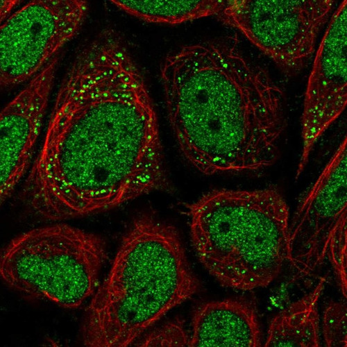 Immunofluorescent staining of human cell line SiHa shows localization to nucleoplasm & lipid droplets.