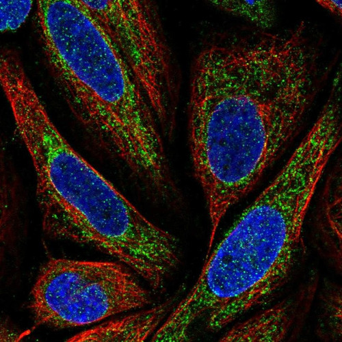 Immunofluorescent staining of human cell line SiHa shows localization to mitochondria.