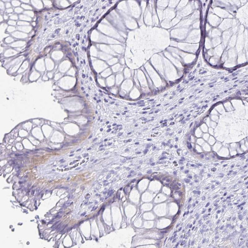 Immunohistochemical staining of human rectum shows weak cytoplasmic positivity in glandular cells.
