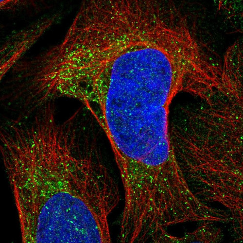 Immunofluorescent staining of human cell line U-2 OS shows localization to vesicles.