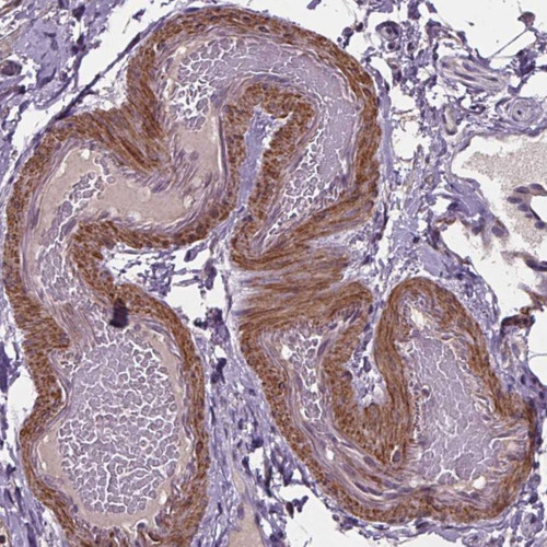 Immunohistochemical staining of human smooth muscle shows strong cytoplasmic positivity in smooth muscle cells.