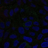 Immunofluorescent staining of human cell line RT4 shows localization to vesicles.