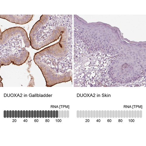 Immunohistochemistry analysis in human gallbladder and skin tissues using HPA063548 antibody. Corresponding DUOXA2 RNA-seq data are presented for the same tissues.
