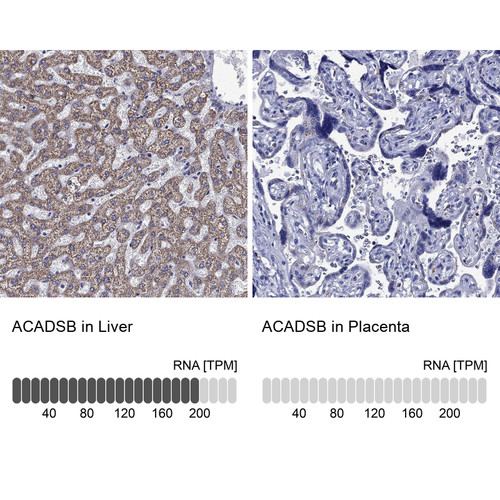 Immunohistochemistry analysis in human liver and placenta tissues using Anti-ACADSB antibody. Corresponding ACADSB RNA-seq data are presented for the same tissues.