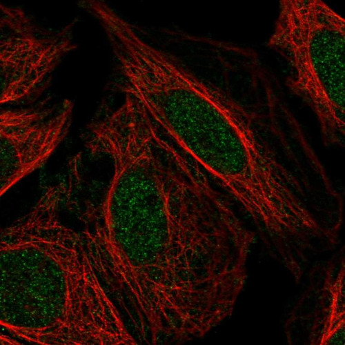 Immunofluorescent staining of human cell line SiHa shows localization to nucleoplasm.