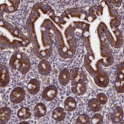 Immunohistochemical staining of human duodenum shows strong granular cytoplasmic positivity in glandular cells.