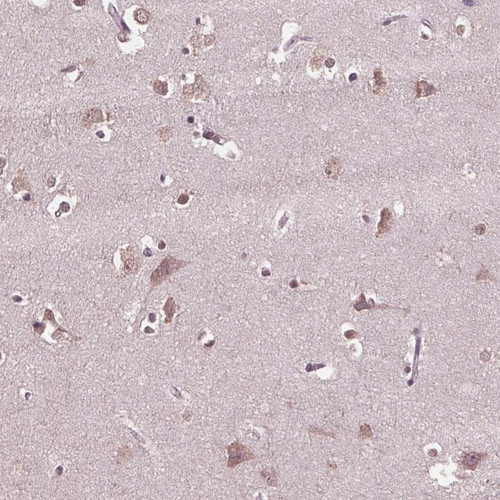 Immunohistochemical staining of human cerebral cortex shows cytoplasmic positivity in neuronal cells.