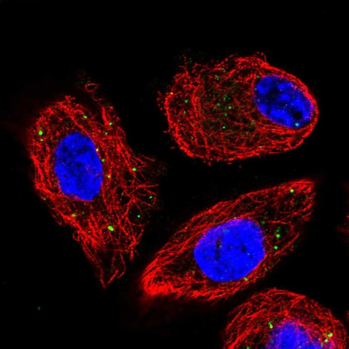 Immunofluorescent staining of human cell line PC-3 shows localization to vesicles.