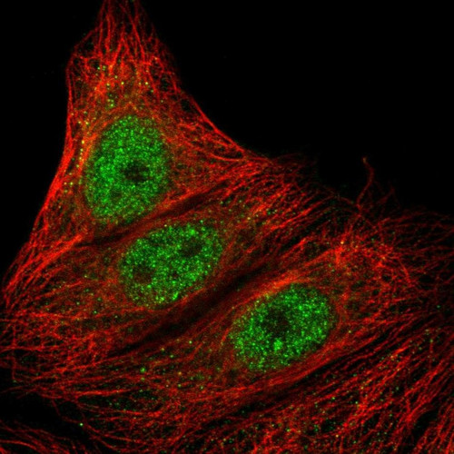 Immunofluorescent staining of human cell line MCF7 shows localization to nucleoplasm & cytosol.