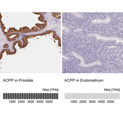Immunohistochemistry analysis in human prostate and endometrium tissues using Anti-ACPP antibody. Corresponding ACPP RNA-seq data are presented for the same tissues.