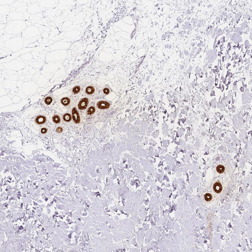 Immunohistochemical staining of human skin shows strong membranous and cytoplasmic positivity in sweat duct cells and secretory cells.