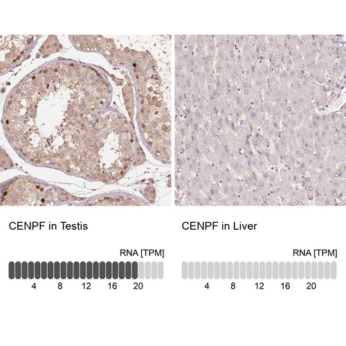 Immunohistochemistry analysis in human testis and liver tissues using Anti-CENPF antibody. Corresponding CENPF RNA-seq data are presented for the same tissues.