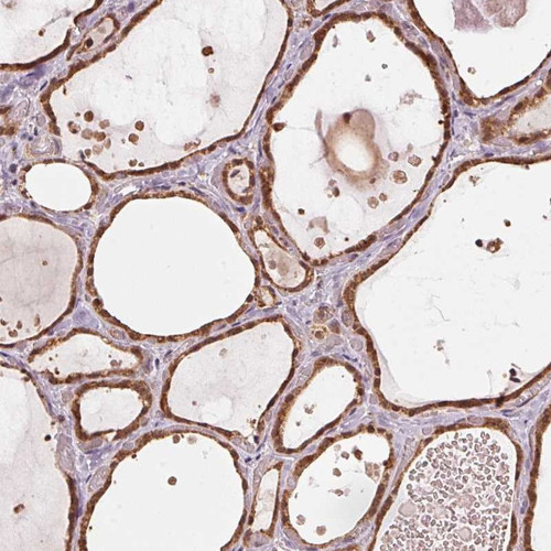Immunohistochemical staining of human thyroid gland shows strong cytoplasmic positivity in glandular cells.