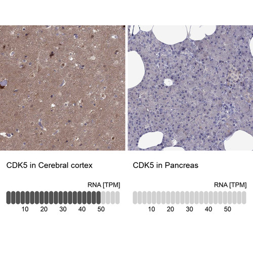 Immunohistochemistry analysis in human cerebral cortex and pancreas tissues using Anti-CDK5 antibody. Corresponding CDK5 RNA-seq data are presented for the same tissues.