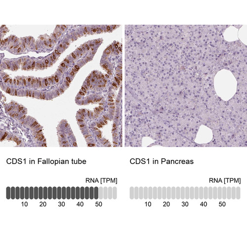 Immunohistochemistry analysis in human fallopian tube and pancreas tissues using Anti-CDS1 antibody. Corresponding CDS1 RNA-seq data are presented for the same tissues.