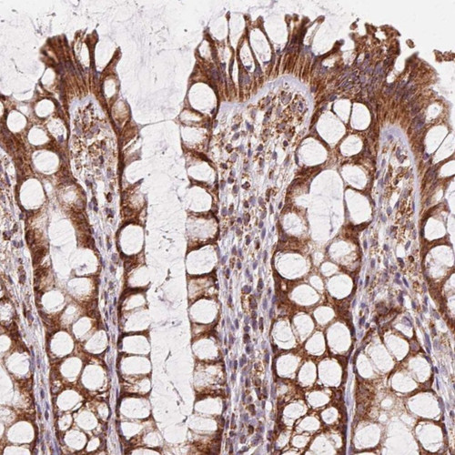 Immunohistochemical staining of human colon shows strong cytoplasmic positivity in glandular cells.