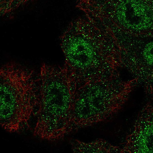 Immunofluorescent staining of human cell line A549 shows localization to nucleoplasm & vesicles.