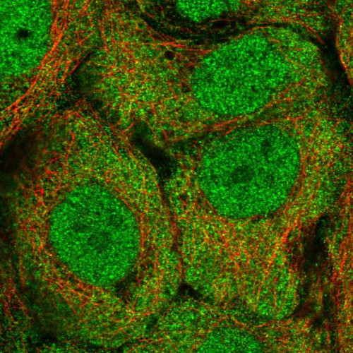 Immunofluorescent staining of human cell line A-431 shows localization to nucleoplasm & cytosol.