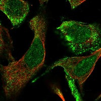 Immunofluorescent staining of human cell line U-2 OS shows localization to nucleoplasm & plasma membrane.